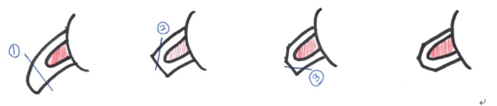爪1.png